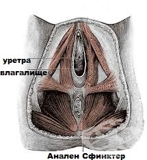 Атрезия девственной плевы