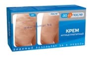 ДО И ПОСЛЕ АНТИЦЕЛУЛИТЕН КРЕМ 100 мл.