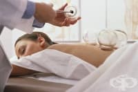 Какво представлява вендузотерапията, видове вендузи и методи на лечение