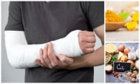 Естествени средства ускоряващи зарастването на счупена кост