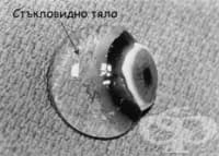 Стъкловидно тяло