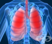 ���� ����� �� 250 ���� �� ����� ���