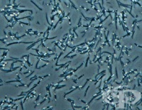 ���-������� �������� � �� ������ �� 3,4 �������� ������