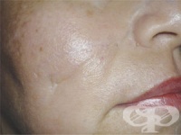 ��������� �� �� ������ � ����� ����