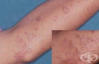 ������� �� � �������� ����� � ����� ����������� � ���������� �� �� ��������