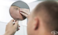 Рискът от сърдечни заболявания при плешивите мъже е пет пъти по-висок