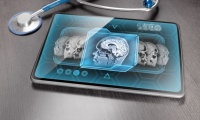 Шизофренията е свързана с дефицит на желязо и загуба на миелин в мозъка