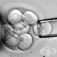 ���� �������� ������ ���� ����� �� �� "���������" ����� ������