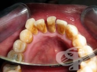 ���� � ����� �� ���������� ������ �����