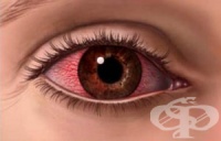 �� ����� ������� ����������� ���