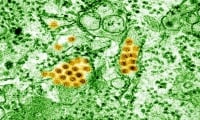 Денга – откриване и история на разпространение на вируса