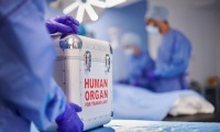 История на даряването на органи и на трансплантациите