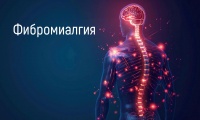 Фибромиалгия
