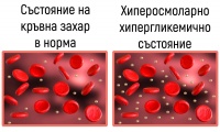 Хиперосмоларен хипергликемичен некетогенен синдром