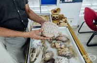 Да държиш човешки мозък в ръце – туристическа атракция в музей в Индия