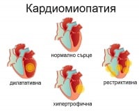 I42 Кардиомиопатия