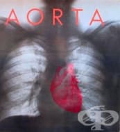 M31.4 ������� �� �������� ���� [Takayasu]