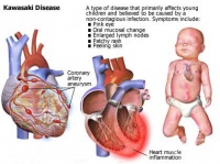 M30.3 ������-�����-�������������� ������� [Kawasaki]