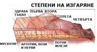 X18 Съприкосновение с други нажежени метали