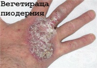 L08.8 Други уточнени локални инфекции на кожата и подкожната тъкан