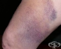 S70 ������������ ������ � ��������  �� ������������� ����� � �������