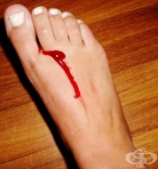 S95.0 ������ �� ������� �������� �����