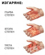 Y27 Контакт с пара, горещи изпарения и горещи предмети, с неопределени намерения