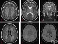 G36.1      [  Hurst]