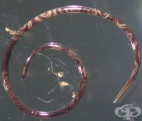 B83.2 a,   Parastrongylus cantonensis