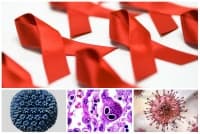 B20.2 Болест, предизвикана от HIV, с прояви на цитомегал-вирусно заболяване