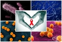B20.1 Болест, предизвикана от HIV, с прояви на други бактериални инфекции