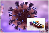 B21.8 Болест, предизвикана от HIV, с прояви на други злокачествени новообразувания