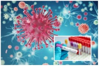 B20.7 Болест, предизвикана от HIV, с прояви на множествени инфекции