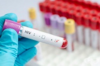 B22.2 Болест, предизвикана от HIV, с прояви на синдром на изтощение