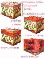 X98 Нападение с прилагане на пара, горещи изпарения и горещи предмети