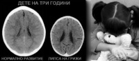 Y06.1 На родители