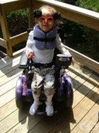 G12.0    , I  [Werdnig-Hoffman]