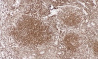 C83.9 ������� ���������� ������, ���������