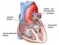 I07.8 Други болести на трикуспидалната клапа