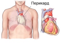 I31 Други болести на перикарда