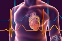 I34.8 Други неревматични болести на митралната клапа