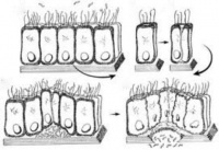 A04.2 Ентероинвазивна инфекция, предизвикана от Escherichia coli