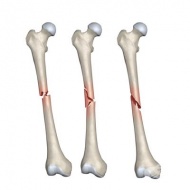 S72.3 �������� �� ������ [�������] �� ��������� ����