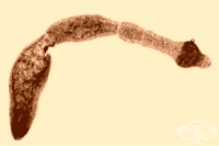 B67.7 Инвазия, предизвикана от Echinococcus multilocularis, неуточнена