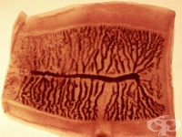 B68.1 ,   Taenia saginata