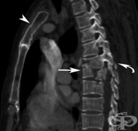 S22.1 ����������� ��������� �� �������� ���� �� ���������� �����