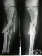 S82.7 ����������� ��������� �� ������������