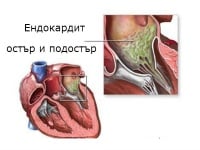Остър и подостър ендокардит Остър и подостър ендокардит