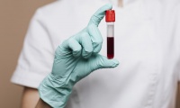 R73.0 Отклонения на резултатите от нормата при теста за толерантност при глюкозата
