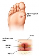 S91.3 ������� ���� �� ����� ����� �� ���������